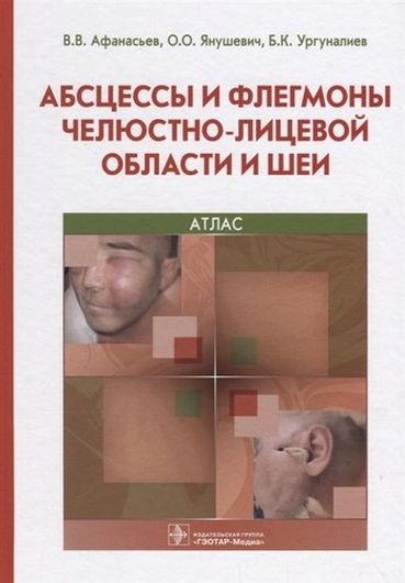 Абсцессы и флегмоны челюстно-лицевой области и шеи 18-19г.